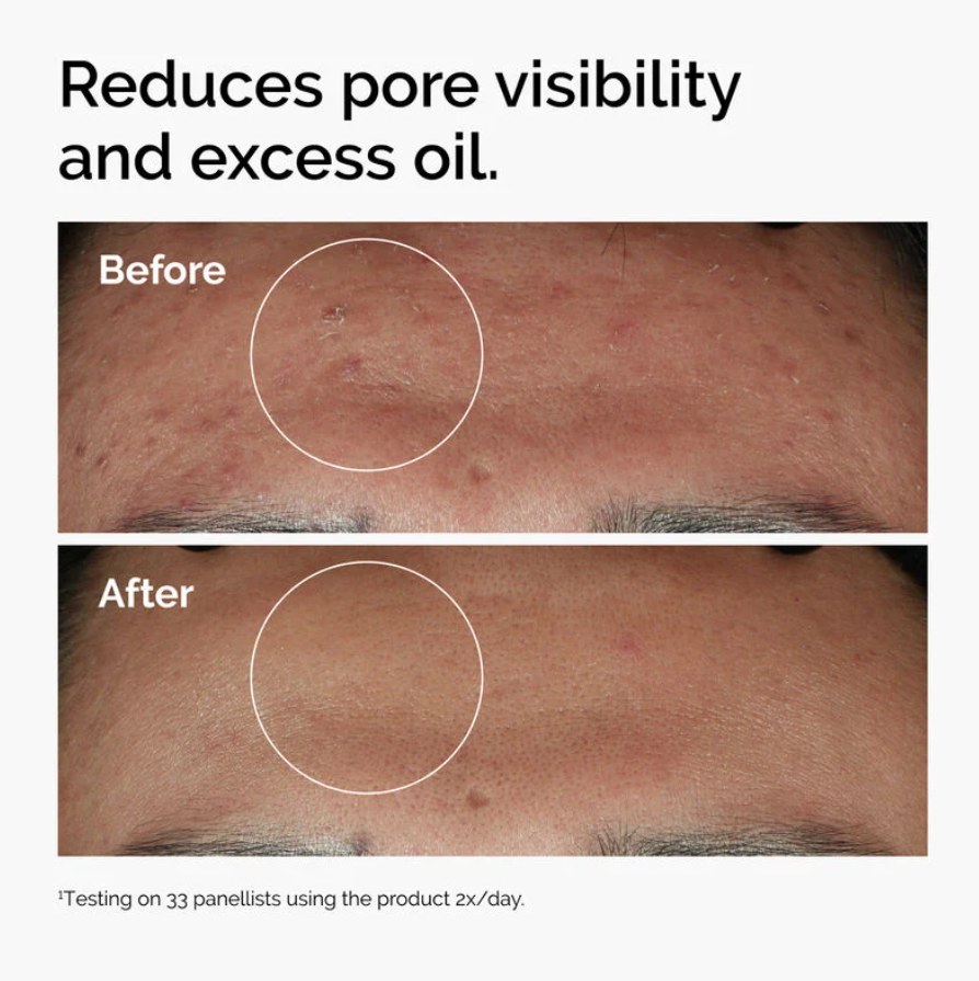 Niacinamide 10% + Zinc 1% 30ml